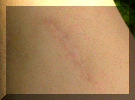 The scar may 2008.